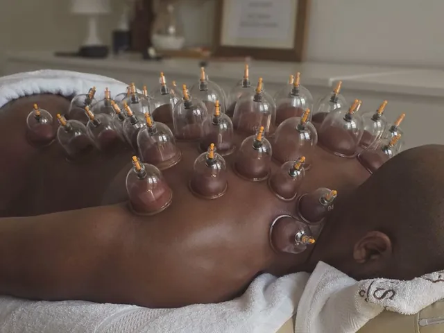 Cupping therapy on the back at home in Dubai