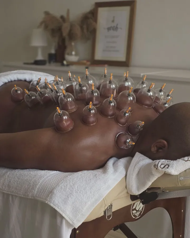 Cupping therapy with glass cups on the back at home in Dubai